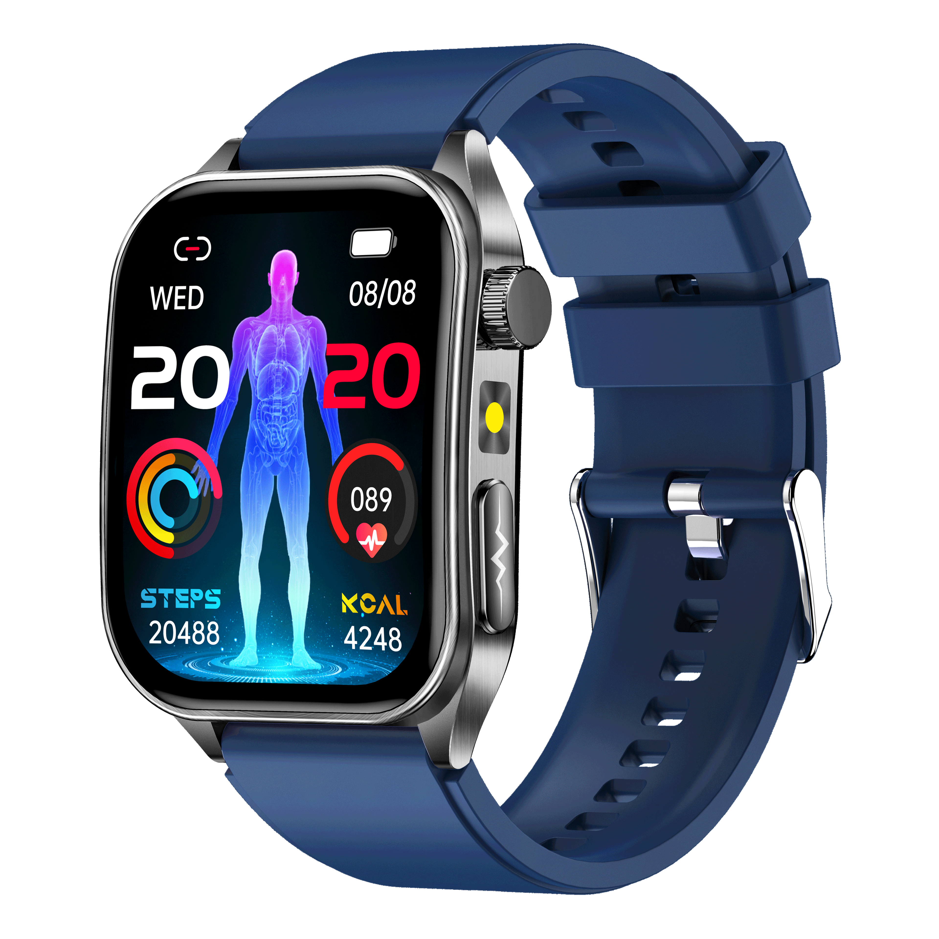 Smartwatch E810 ECG Blood lipid blood oxygen uric acid body temperature monitoring